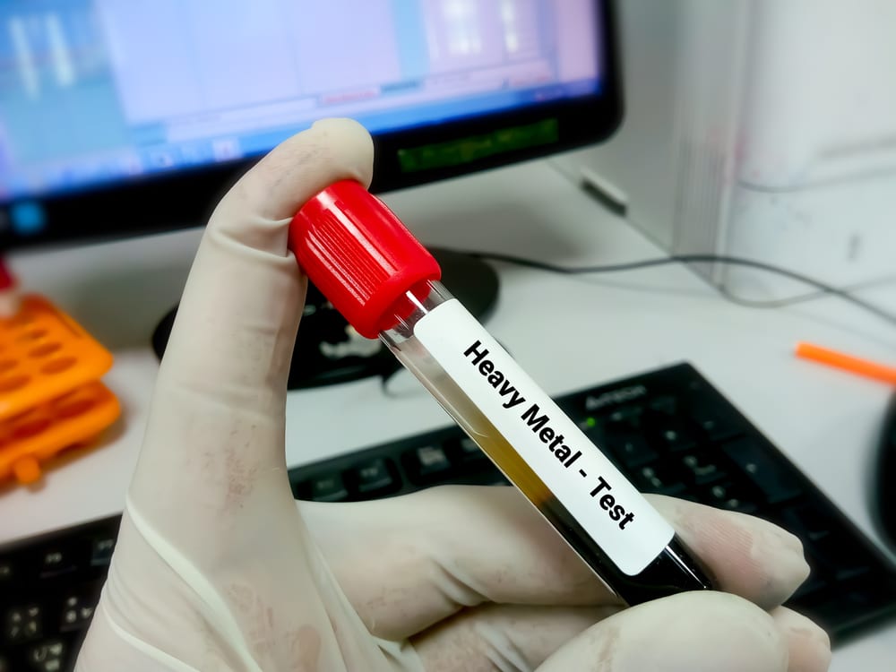 Blood,Sample,For,Heavy,Metal,Test.,Blood,Toxicity,Test